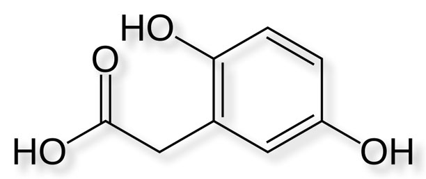 The chemical structure of homogentistic acid (HGA), the substance that accumulates in the bodies of AKU patients at more than 2,000 times the normal rate due to a genetic mutation. Image courtesy of AKU Society.  